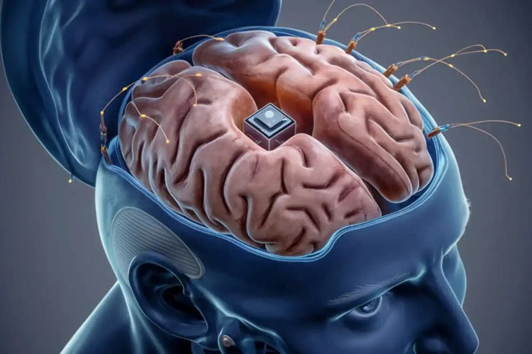 تراشهای که با کمک هوش مصنوعی میتواند حافظه آسیبدیدگان مغزی را تقویت کند